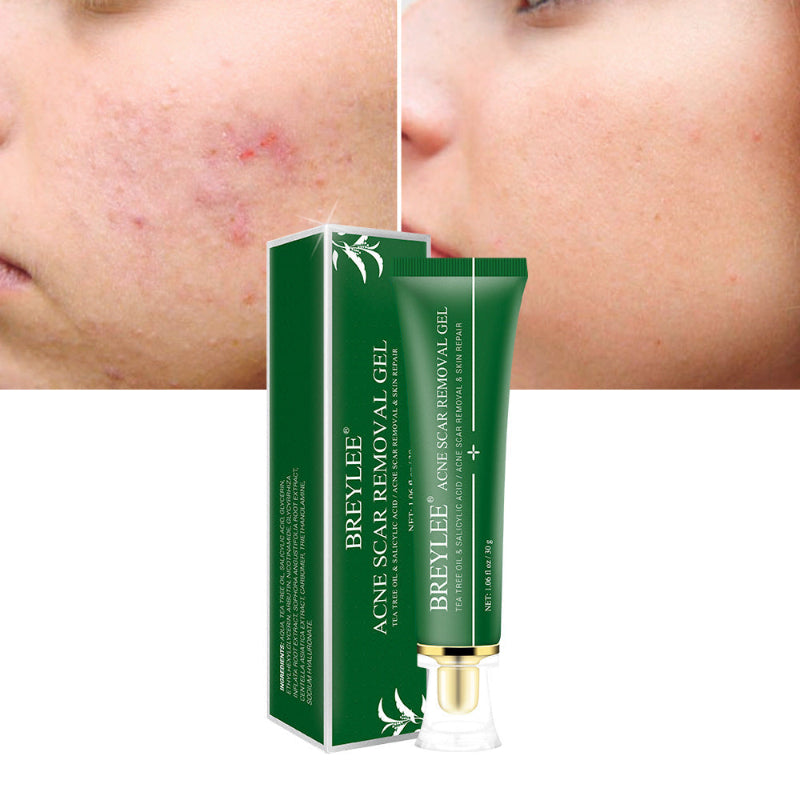 Gel Reparador de Cicatrices de Acné con Árbol de Té – Cuidado y Regeneración