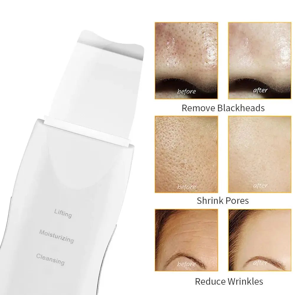 Skin Scrubber Pro: Limpieza Profunda y Exfoliación para un Rostro Radiante